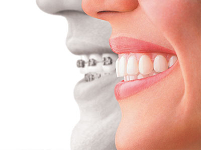 Mywisdom Dental | Extractions, Emergency Treatment and Dental Cleanings