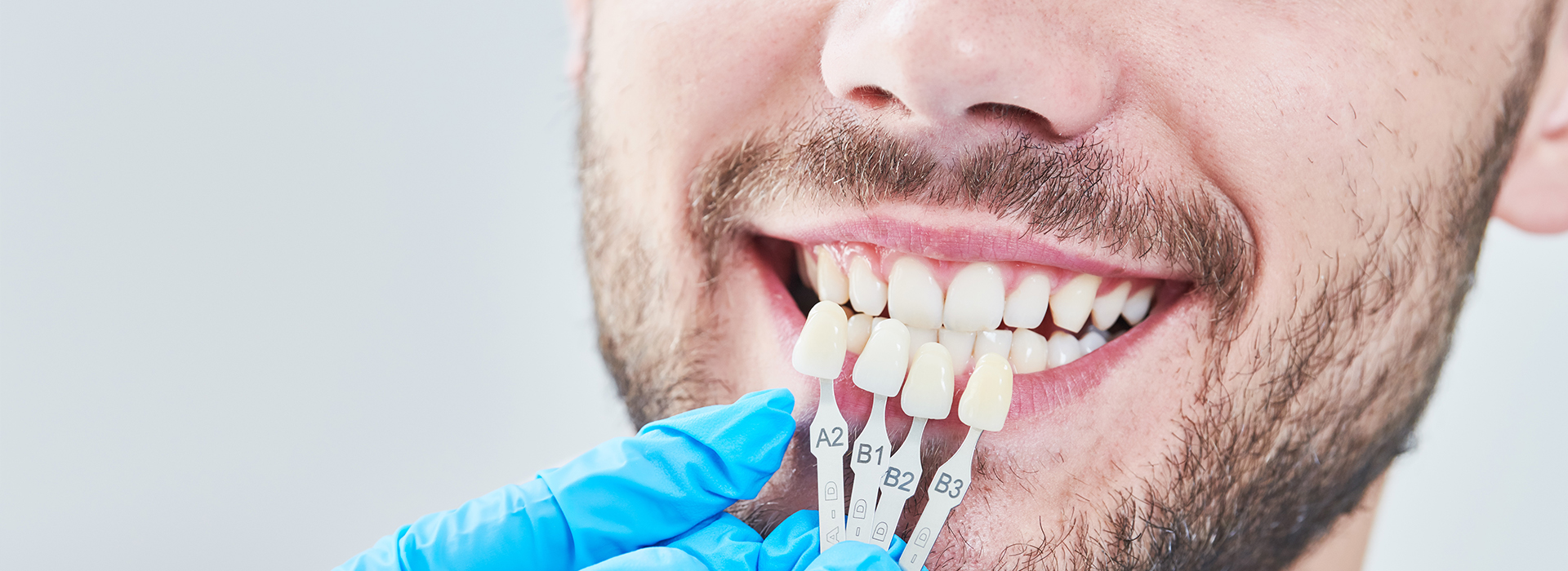 Mywisdom Dental | Oral Cancer Screening, Teeth Whitening and ViziLite reg 