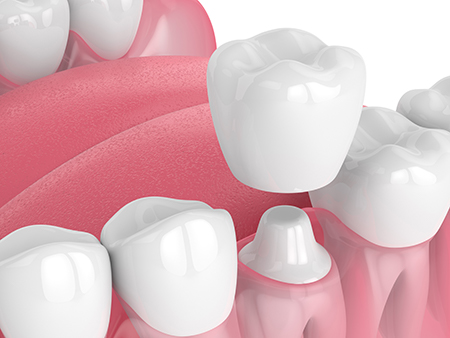 Mywisdom Dental